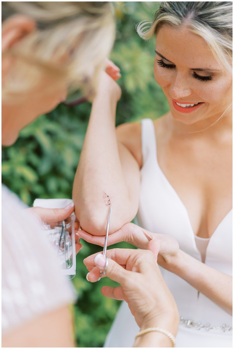photo of brides mom removing her stitches on her wedding day